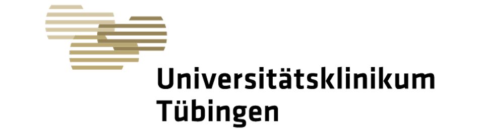 Tübingen University Hospital